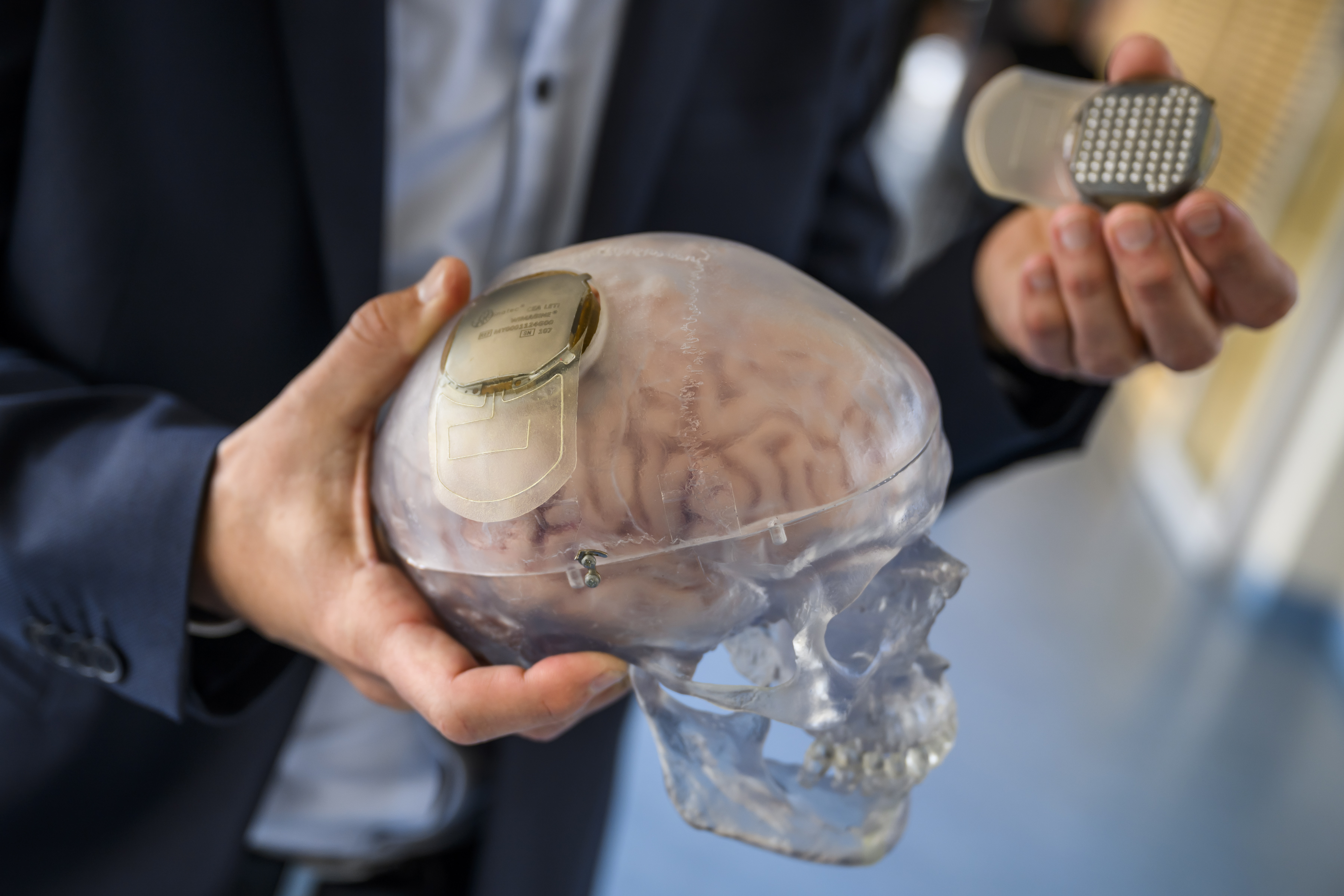 Breakthrough in science: world's first 3D brain tissue printed