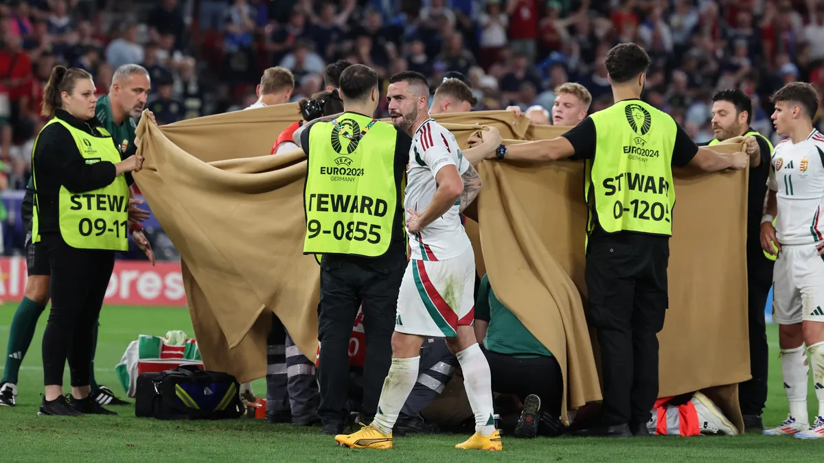 The injured Hungarian striker Barnabas Varga has facial fractures and will undergo surgery